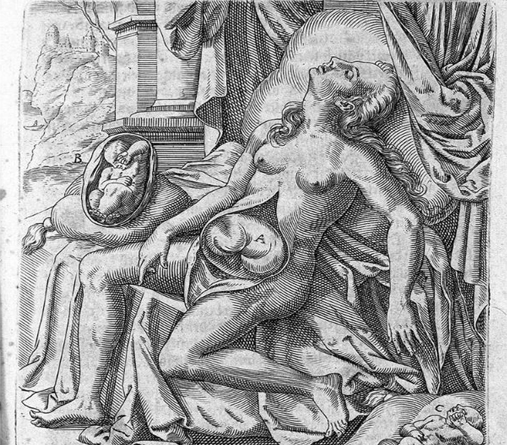 Auszug aus dem Hebammenbuch Louise Bourgeois